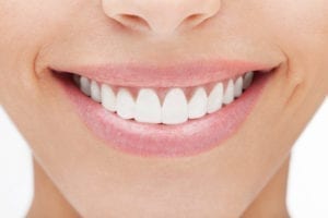 Affordable gum Reshaping in Plano, TX