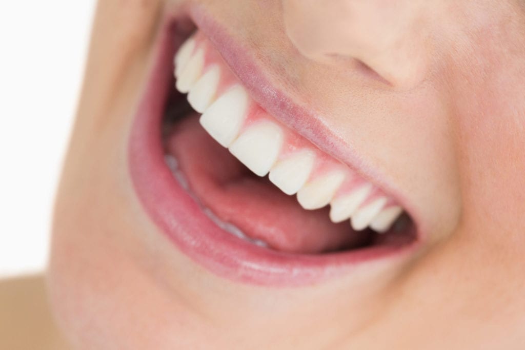 Fix broken teeth in Dallas TX with Dr. Mark Sowell
