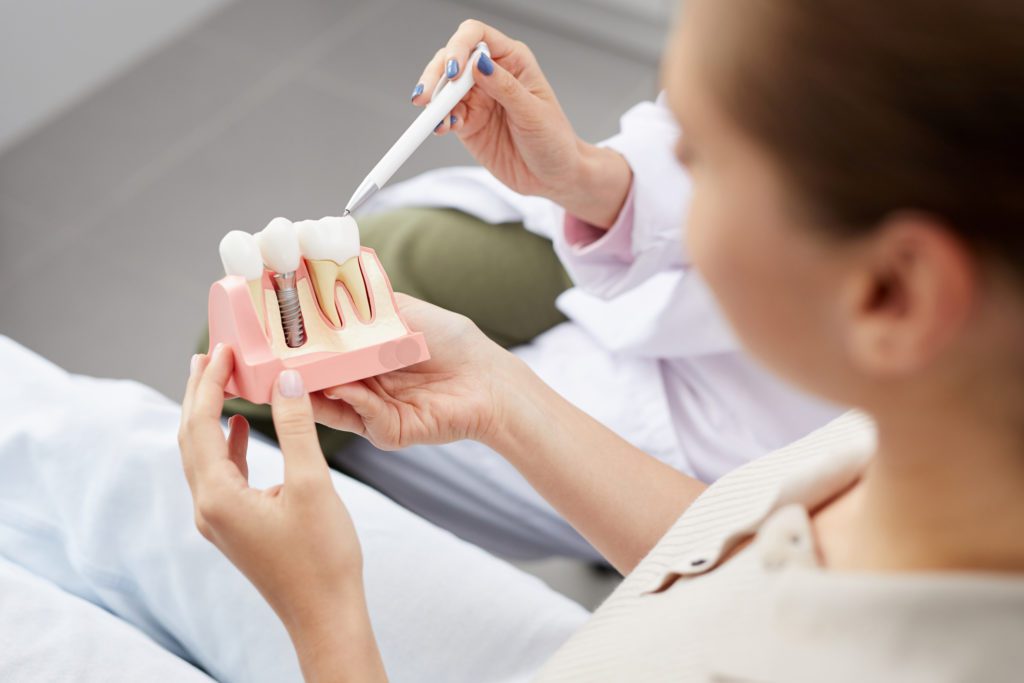 Dental Implants in Plano, Texas