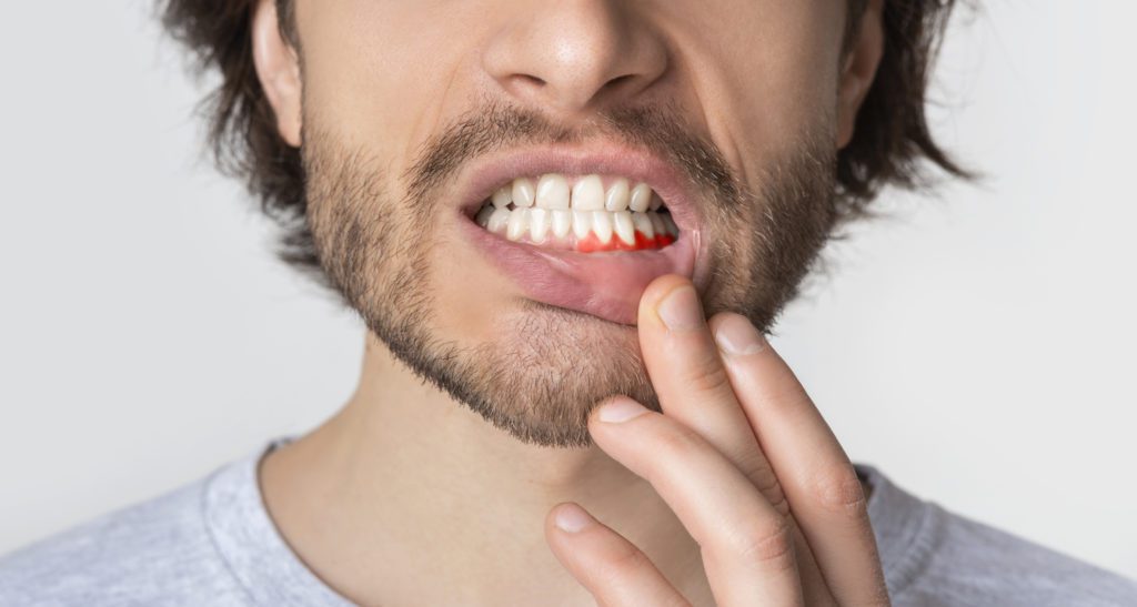 Treat Gum Disease in Plano, TX