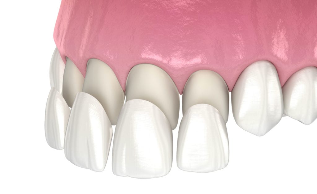cosmetic dentist in plano, texas
