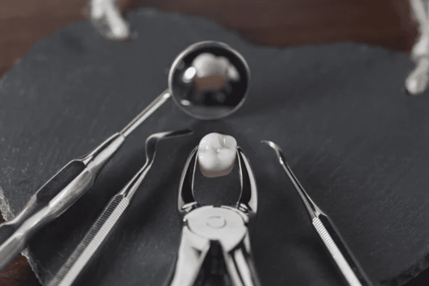 tooth sitting amongst extraction tools wisdom teeth dentists in Plano Texas