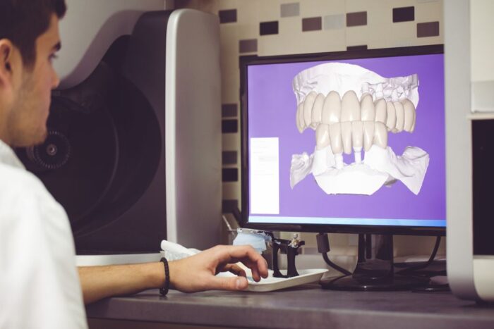 Precise Impressions in Fixed Prosthodontics