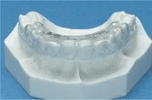 Affordable TMJ Therapy with Dr. Mark Sowell in Plano and Dallas TX