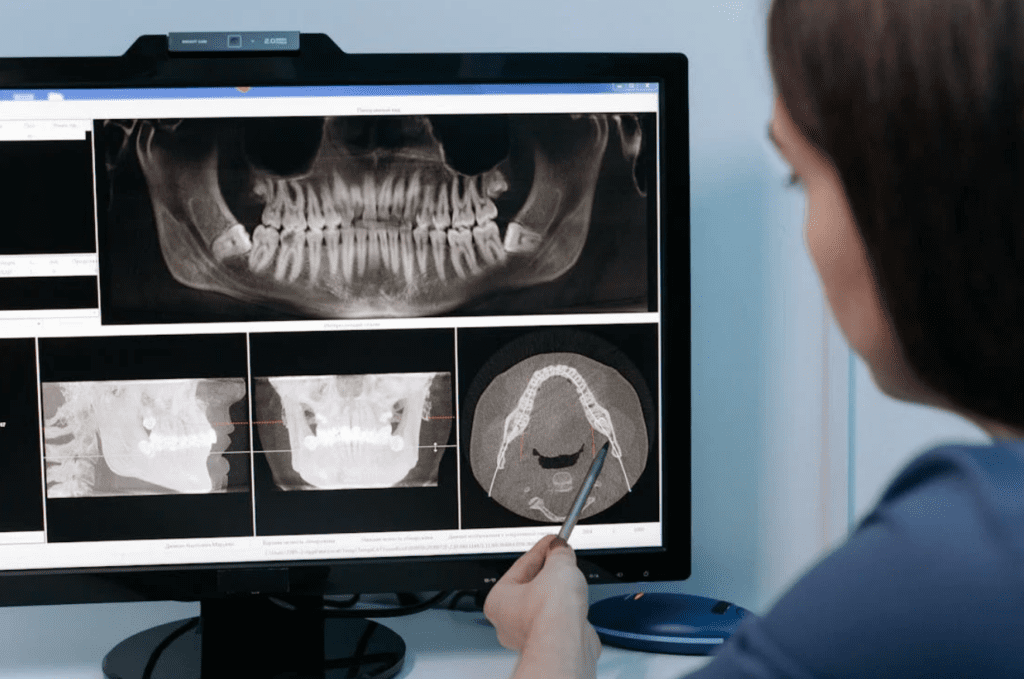 TMJ disorder analysis at the dentist