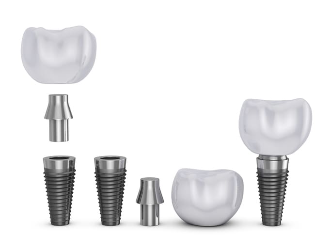Cost of dental implants in Plano, TX