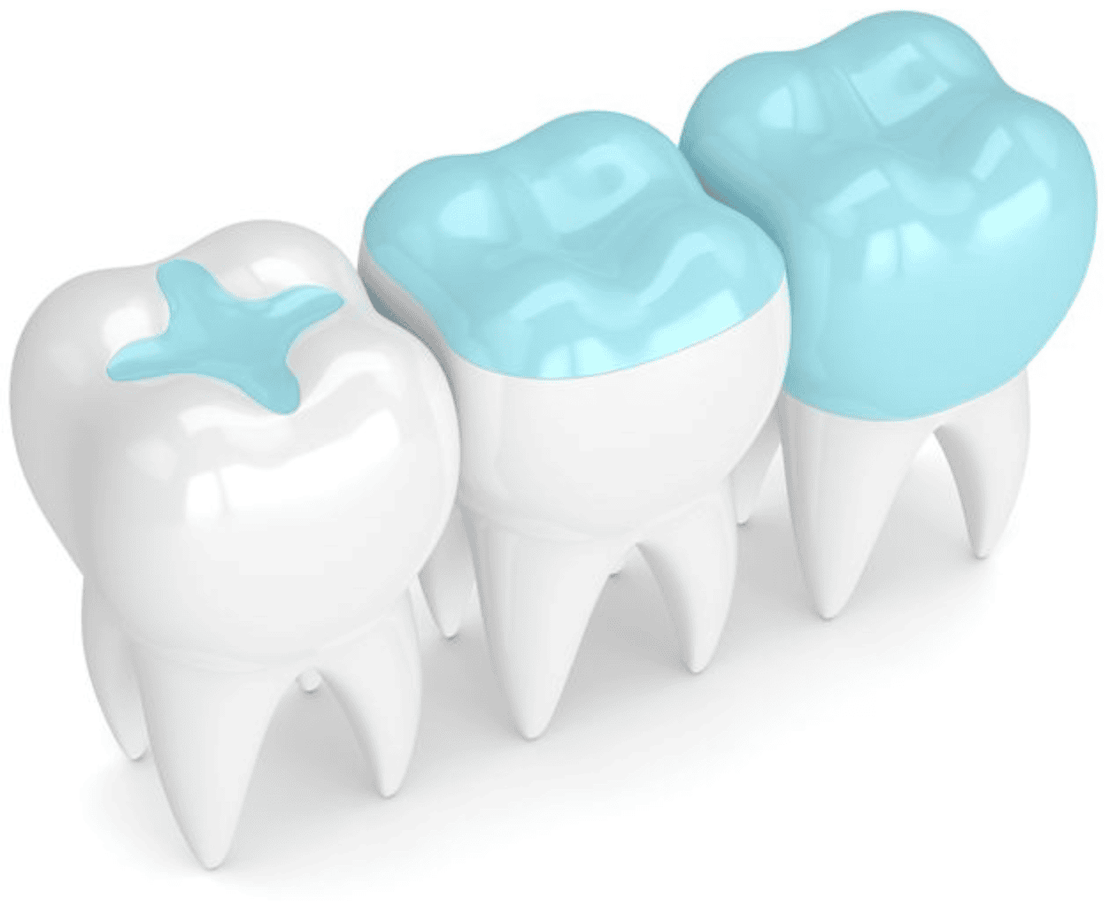 How Much Does Tooth Bonding Cost in Plano, TX